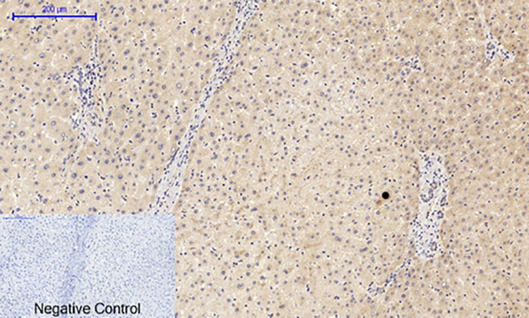 Fig.2. Immunohistochemical analysis of paraffin-embedded human liver tissue. 1, PI 3-kinase p85α (phospho Tyr607) Polyclonal Antibody was diluted at 1:200 (4°C, overnight). 2, Sodium citrate pH 6.0 was used for antibody retrieval (>98°C, 20min). 3, secondary antibody was diluted at 1:200 (room temperature, 30min). Negative control was used by secondary antibody only.