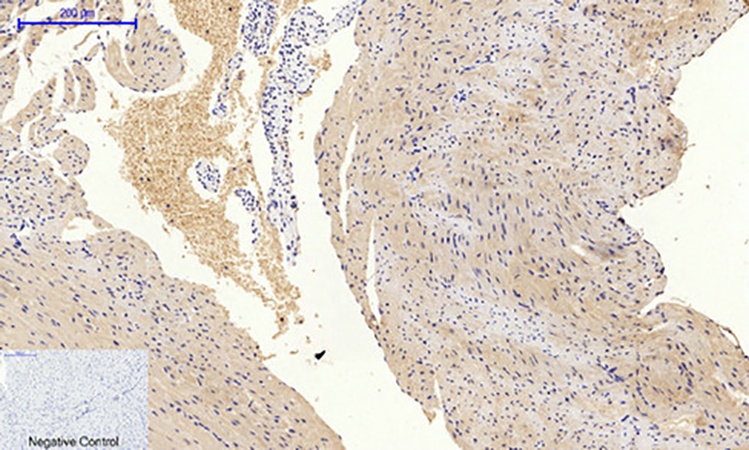 Fig.3. Immunohistochemical analysis of paraffin-embedded mouse heart tissue. 1, PI 3-kinase p85α (phospho Tyr607) Polyclonal Antibody was diluted at 1:200 (4°C, overnight). 2, Sodium citrate pH 6.0 was used for antibody retrieval (>98°C, 20min). 3, secondary antibody was diluted at 1:200 (room temperature, 30min). Negative control was used by secondary antibody only.