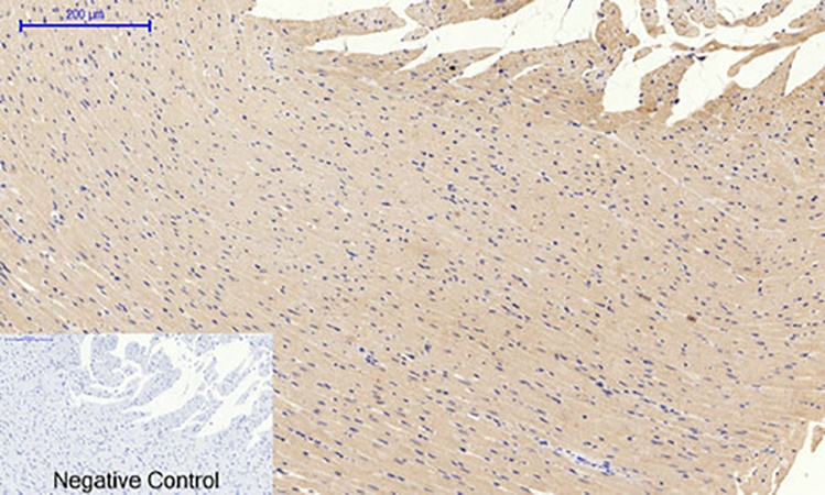 Fig.4. Immunohistochemical analysis of paraffin-embedded rat heart tissue. 1, PI 3-kinase p85α (phospho Tyr607) Polyclonal Antibody was diluted at 1:200 (4°C, overnight). 2, Sodium citrate pH 6.0 was used for antibody retrieval (>98°C, 20min). 3, secondary antibody was diluted at 1:200 (room temperature, 30min). Negative control was used by secondary antibody only.