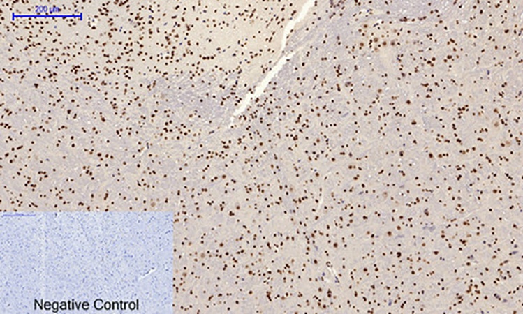 Fig.3. Immunohistochemical analysis of paraffin-embedded mouse brain tissue. 1, JNK1/2/3 (phospho Tyr185) Polyclonal Antibody was diluted at 1:200 (4°C, overnight). 2, Sodium citrate pH 6.0 was used for antibody retrieval (>98°C, 20min). 3, secondary antibody was diluted at 1:200 (room temperature, 30min). Negative control was used by secondary antibody only.