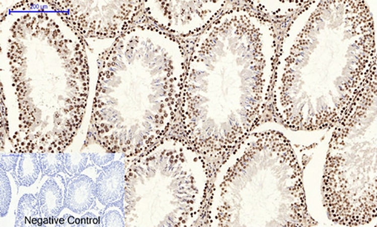 Fig.4. Immunohistochemical analysis of paraffin-embedded rat testis tissue. 1, JNK1/2/3 (phospho Tyr185) Polyclonal Antibody was diluted at 1:200 (4°C, overnight). 2, Sodium citrate pH 6.0 was used for antibody retrieval (>98°C, 20min). 3, secondary antibody was diluted at 1:200 (room temperature, 30min). Negative control was used by secondary antibody only.