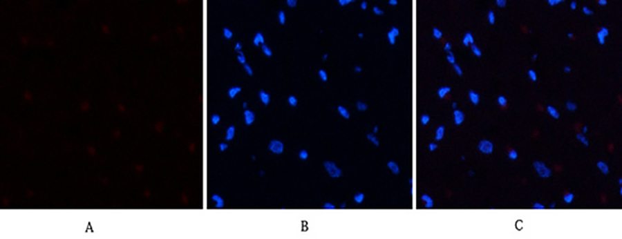 Fig.2. Immunofluorescence analysis of rat heart tissue. 1, PERK (phospho Thr981)  Polyclonal Antibody (red)  was diluted at 1:200 (4°C, overnight). 2, Cy3 labeled secondary antibody was diluted at 1:300 (room temperature, 50min). 3, Picture B: DAPI (blue)  10min. Picture A: Target. Picture B: DAPI. Picture C: merge of A+B.