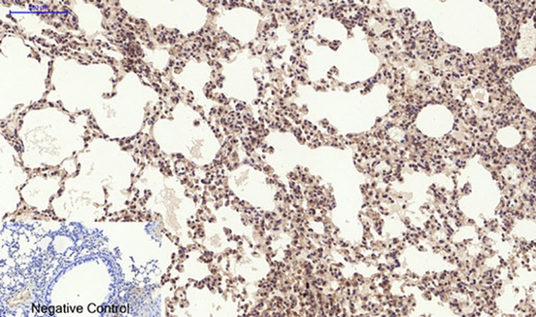 Fig.4. Immunohistochemical analysis of paraffin-embedded mouse lung tissue. 1, PERK (phospho Thr981) Polyclonal Antibody was diluted at 1:200 (4°C, overnight). 2, Sodium citrate pH 6.0 was used for antibody retrieval (>98°C, 20min). 3, secondary antibody was diluted at 1:200 (room temperature, 30min). Negative control was used by secondary antibody only.
