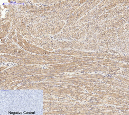 Fig.1. Immunohistochemical analysis of paraffin-embedded human uterus tissue. 1, Actin β Polyclonal Antibody was diluted at 1:200 (4°C, overnight). 2, Sodium citrate pH 6.0 was used for antibody retrieval (>98°C, 20min). 3, secondary antibody was diluted at 1:200 (room temperature, 30min). Negative control was used by secondary antibody only.