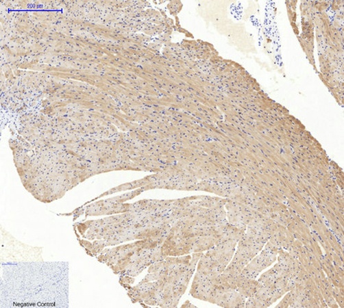 Fig.2. Immunohistochemical analysis of paraffin-embedded mouse heart tissue. 1, Actin β Polyclonal Antibody was diluted at 1:200 (4°C, overnight). 2, Sodium citrate pH 6.0 was used for antibody retrieval (>98°C, 20min). 3, secondary antibody was diluted at 1:200 (room temperature, 30min). Negative control was used by secondary antibody only.