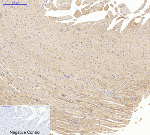 Fig.3. Immunohistochemical analysis of paraffin-embedded rat heart tissue. 1, Actin β Polyclonal Antibody was diluted at 1:200 (4°C, overnight). 2, Sodium citrate pH 6.0 was used for antibody retrieval (>98°C, 20min). 3, secondary antibody was diluted at 1:200 (room temperature, 30min). Negative control was used by secondary antibody only.