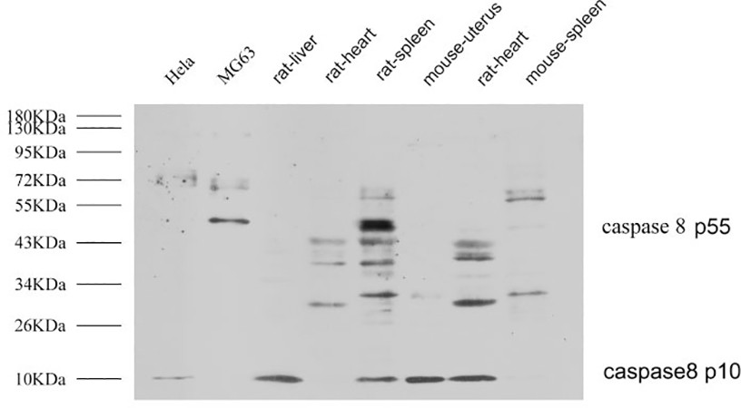 Fig.3. Western Blot analysis of Hela (1), MG63 (2), rat liver (3), rat heart (4), rat spleen (5), mouse uterus (6), rat heart (7), mouse spleen (8), diluted at 1:1000.