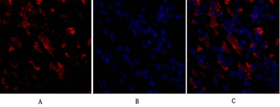 Fig.2. Immunofluorescence analysis of human stomach tissue. 1, CD284 Polyclonal Antibody (red) was diluted at 1:200 (4°C, overnight). 2, Cy3 labeled secondary antibody was diluted at 1:300 (room temperature, 50min). 3, Picture B: DAPI (blue) 10min. Picture A: Target. Picture B: DAPI. Picture C: merge of A+B.