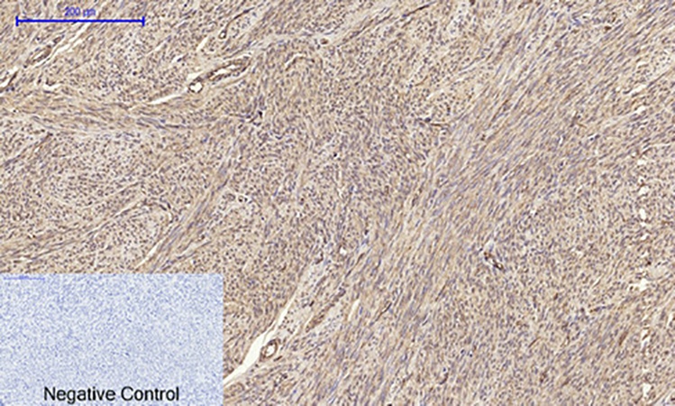 Fig.3. Immunohistochemical analysis of paraffin-embedded human uterus tissue. 1, Claudin-5 Polyclonal Antibody was diluted at 1:200 (4°C, overnight). 2, Sodium citrate pH 6.0 was used for antibody retrieval (>98°C, 20min). 3, secondary antibody was diluted at 1:200 (room temperature, 30min). Negative control was used by secondary antibody only.