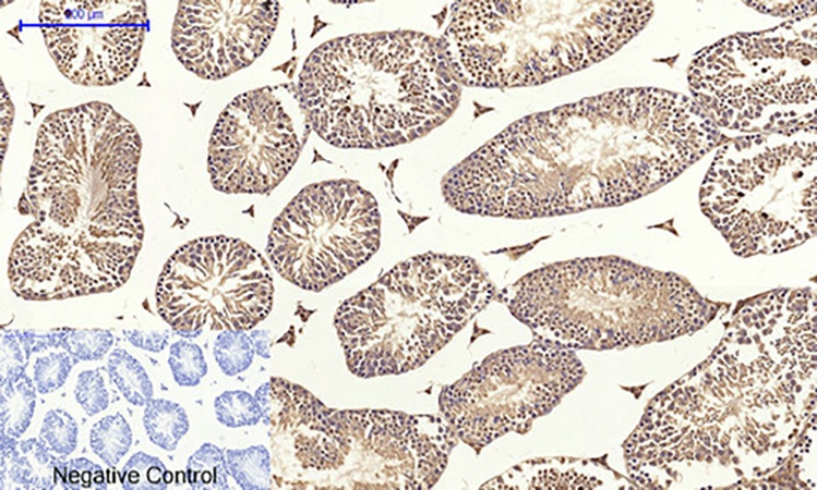 Fig.4. Immunohistochemical analysis of paraffin-embedded mouse testis tissue. 1, Claudin-5 Polyclonal Antibody was diluted at 1:200 (4°C, overnight). 2, Sodium citrate pH 6.0 was used for antibody retrieval (>98°C, 20min). 3, secondary antibody was diluted at 1:200 (room temperature, 30min). Negative control was used by secondary antibody only.