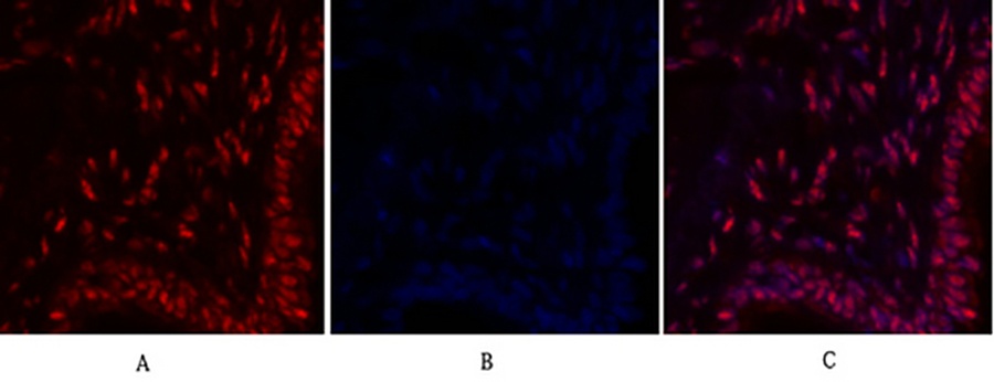 Fig.2. Immunofluorescence analysis of human lung tissue. 1, c-Myc Polyclonal Antibody (red) was diluted at 1:200 (4°C, overnight). 2, Cy3 labeled secondary antibody was diluted at 1:300 (room temperature, 50min). 3, Picture B: DAPI (blue) 10min. Picture A: Target. Picture B: DAPI. Picture C: merge of A+B.