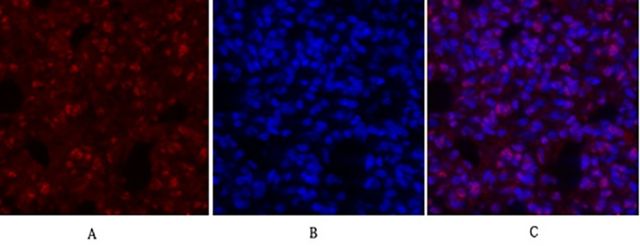 Fig.3. Immunofluorescence analysis of rat lung tissue. 1, c-Myc Polyclonal Antibody (red) was diluted at 1:200 (4°C, overnight). 2, Cy3 labeled secondary antibody was diluted at 1:300 (room temperature, 50min). 3, Picture B: DAPI (blue) 10min. Picture A: Target. Picture B: DAPI. Picture C: merge of A+B.