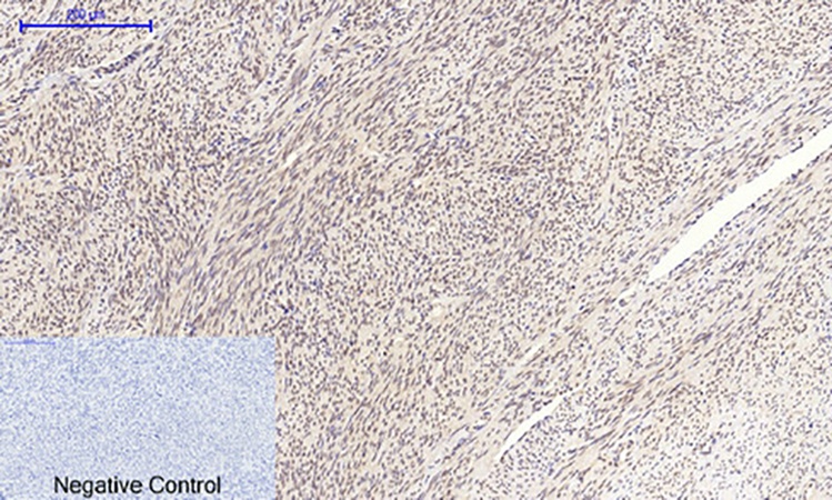 Fig.4. Immunohistochemical analysis of paraffin-embedded human uterus tissue. 1, c-Myc Polyclonal Antibody was diluted at 1:200 (4°C, overnight). 2, Sodium citrate pH 6.0 was used for antibody retrieval (>98°C, 20min). 3, secondary antibody was diluted at 1:200 (room temperature, 30min). Negative control was used by secondary antibody only.