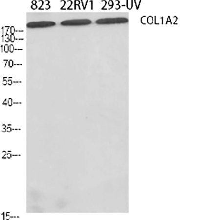Fig.1. Western Blot analysis of 823 (1), 22RV1 (2), 293-UV (3), diluted at 1:500.