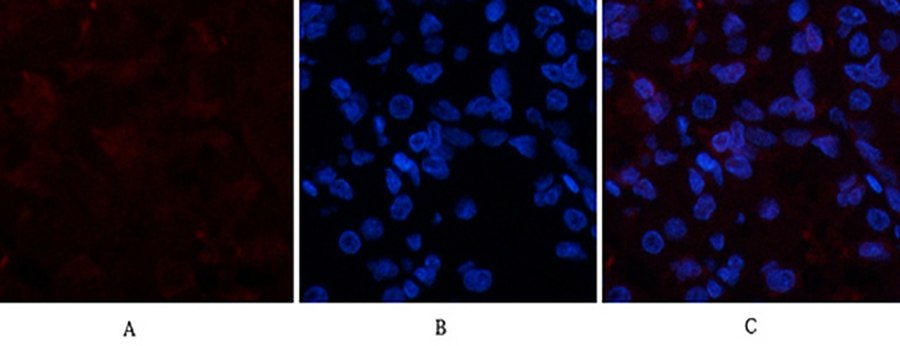 Fig.2. Immunofluorescence analysis of human stomach tissue. 1, COL1A2 Polyclonal Antibody (red) was diluted at 1:200 (4°C, overnight). 2, Cy3 labeled secondary antibody was diluted at 1:300 (room temperature, 50min). 3, Picture B: DAPI (blue) 10min. Picture A: Target. Picture B: DAPI. Picture C: merge of A+B.