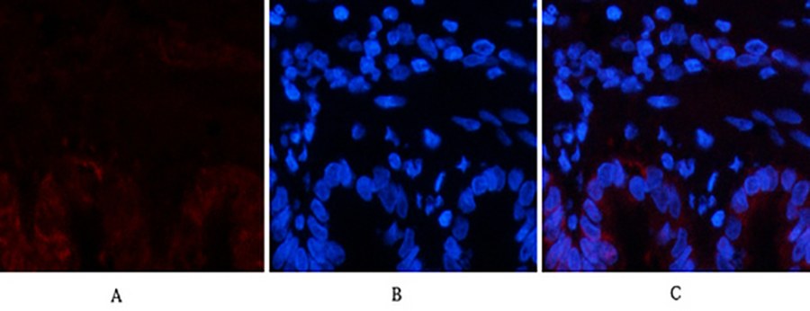 Fig.3. Immunofluorescence analysis of rat lung tissue. 1, COL1A2 Polyclonal Antibody (red) was diluted at 1:200 (4°C, overnight). 2, Cy3 labeled secondary antibody was diluted at 1:300 (room temperature, 50min). 3, Picture B: DAPI (blue) 10min. Picture A: Target. Picture B: DAPI. Picture C: merge of A+B.