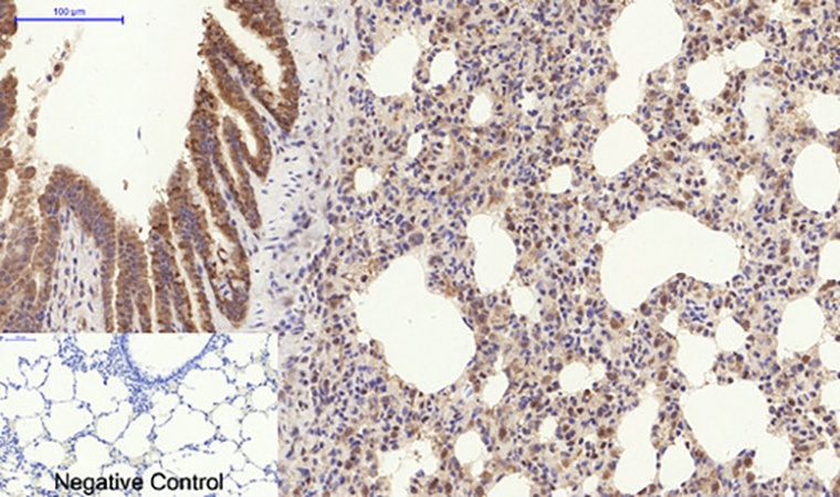 Fig.5. Immunohistochemical analysis of paraffin-embedded rat lung tissue. 1, COL1A2 Polyclonal Antibody was diluted at 1:200 (4°C, overnight). 2, Sodium citrate pH 6.0 was used for antibody retrieval (>98°C, 20min). 3, secondary antibody was diluted at 1:200 (room temperature, 30min). Negative control was used by secondary antibody only.