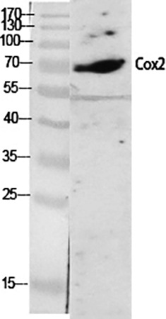 Fig.1. Western Blot analysis of various cells using Cox-2 Polyclonal Antibody diluted at 1:2000.