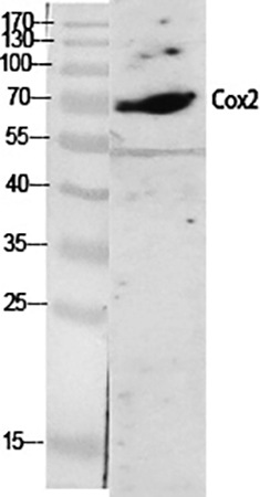 Fig.1. Western Blot analysis of various cells using Cox-2 Polyclonal Antibody diluted at 1:2000.