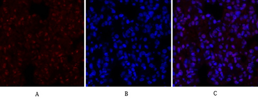 Fig.3. Immunofluorescence analysis of rat lung tissue. 1, CREB-1 Polyclonal Antibody (red) was diluted at 1:200 (4°C, overnight). 2, Cy3 labeled secondary antibody was diluted at 1:300 (room temperature, 50min). 3, Picture B: DAPI (blue) 10min. Picture A: Target. Picture B: DAPI. Picture C: merge of A+B.