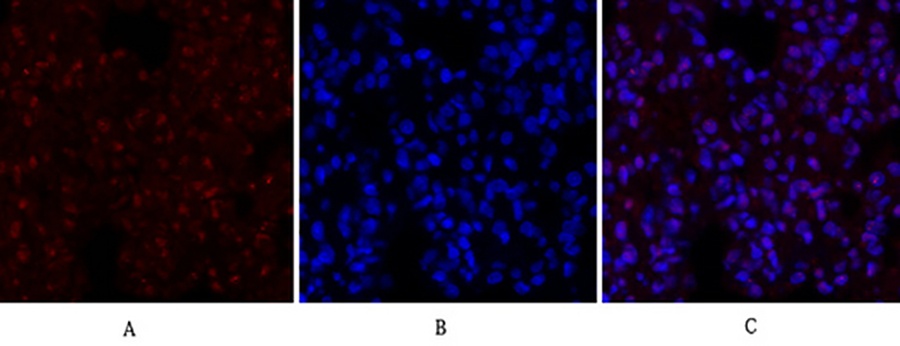 Fig.3. Immunofluorescence analysis of rat lung tissue. 1, CREB-1 Polyclonal Antibody (red) was diluted at 1:200 (4°C, overnight). 2, Cy3 labeled secondary antibody was diluted at 1:300 (room temperature, 50min). 3, Picture B: DAPI (blue) 10min. Picture A: Target. Picture B: DAPI. Picture C: merge of A+B.