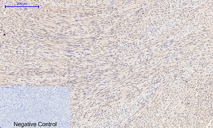 Fig.2. Immunohistochemical analysis of paraffin-embedded human uterus tissue. 1, Cyclin B1 Polyclonal Antibody was diluted at 1:200 (4°C, overnight). 2, Sodium citrate pH 6.0 was used for antibody retrieval (>98°C, 20min). 3, secondary antibody was diluted at 1:200 (room temperature, 30min). Negative control was used by secondary antibody only.