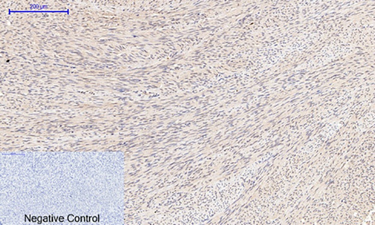 Fig.2. Immunohistochemical analysis of paraffin-embedded human uterus tissue. 1, Cyclin B1 Polyclonal Antibody was diluted at 1:200 (4°C, overnight). 2, Sodium citrate pH 6.0 was used for antibody retrieval (>98°C, 20min). 3, secondary antibody was diluted at 1:200 (room temperature, 30min). Negative control was used by secondary antibody only.