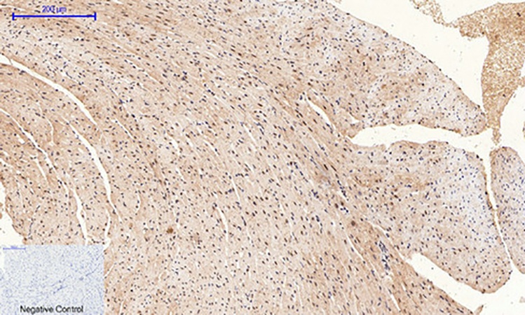 Fig.3. Immunohistochemical analysis of paraffin-embedded mouse heart tissue. 1, Cyclin B1 Polyclonal Antibody was diluted at 1:200 (4°C, overnight). 2, Sodium citrate pH 6.0 was used for antibody retrieval (>98°C, 20min). 3, secondary antibody was diluted at 1:200 (room temperature, 30min). Negative control was used by secondary antibody only.