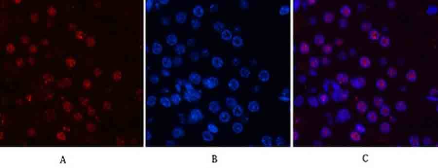 Fig.5. Immunofluorescence analysis of mouse kidney tissue. 1, Cyclin B1 Polyclonal Antibody (red) was diluted at 1:200 (4°C, overnight). 2, Cy3 labeled secondary antibody was diluted at 1:300 (room temperature, 50min). 3, Picture B: DAPI (blue) 10min. Picture A: Target. Picture B: DAPI. Picture C: merge of A+B.