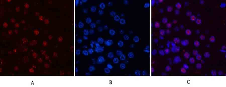Fig.5. Immunofluorescence analysis of mouse kidney tissue. 1, Cyclin B1 Polyclonal Antibody (red) was diluted at 1:200 (4°C, overnight). 2, Cy3 labeled secondary antibody was diluted at 1:300 (room temperature, 50min). 3, Picture B: DAPI (blue) 10min. Picture A: Target. Picture B: DAPI. Picture C: merge of A+B.