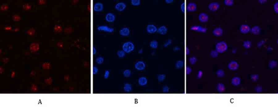 Fig.6. Immunofluorescence analysis of rat liver tissue. 1, Cyclin B1 Polyclonal Antibody (red) was diluted at 1:200 (4°C, overnight). 2, Cy3 labeled secondary antibody was diluted at 1:300 (room temperature, 50min). 3, Picture B: DAPI (blue) 10min. Picture A: Target. Picture B: DAPI. Picture C: merge of A+B.