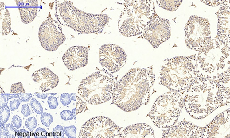Fig.5. Immunohistochemical analysis of paraffin-embedded mouse testis tissue. 1, DRP1 Polyclonal Antibody was diluted at 1:200 (4°C, overnight). 2, Sodium citrate pH 6.0 was used for antibody retrieval (>98°C, 20min). 3, secondary antibody was diluted at 1:200 (room temperature, 30min). Negative control was used by secondary antibody only.