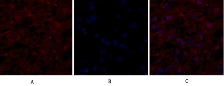 Fig.1. Immunofluorescence analysis of human liver tissue. 1, eIF2α Polyclonal Antibody (red) was diluted at 1:200 (4°C, overnight). 2, Cy3 Labeled secondary antibody was diluted at 1:300 (room temperature, 50min). 3, Picture B: DAPI (blue) 10min. Picture A: Target. Picture B: DAPI. Picture C: merge of A+B.