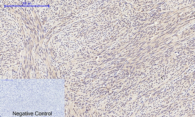 Fig.3. Immunohistochemical analysis of paraffin-embedded human uterus tissue. 1, eIF2α Polyclonal Antibody was diluted at 1:200 (4°C, overnight). 2, Sodium citrate pH 6.0 was used for antibody retrieval (>98°C, 20min). 3, secondary antibody was diluted at 1:200 (room temperature, 30min). Negative control was used by secondary antibody only.