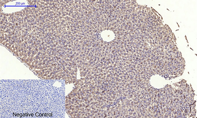 Fig.4. Immunohistochemical analysis of paraffin-embedded mouse liver tissue. 1, eIF2α Polyclonal Antibody was diluted at 1:200 (4°C, overnight). 2, Sodium citrate pH 6.0 was used for antibody retrieval (>98°C, 20min). 3, secondary antibody was diluted at 1:200 (room temperature, 30min). Negative control was used by secondary antibody only.