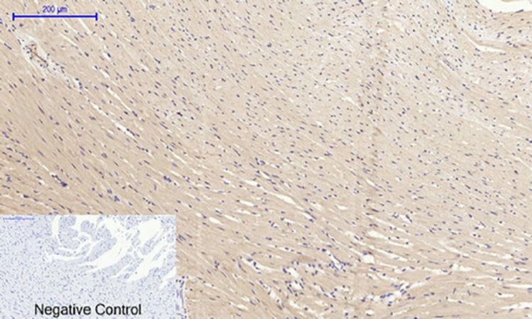 Fig.5. Immunohistochemical analysis of paraffin-embedded rat heart tissue. 1, eIF2α Polyclonal Antibody was diluted at 1:200 (4°C, overnight). 2, Sodium citrate pH 6.0 was used for antibody retrieval (>98°C, 20min). 3, secondary antibody was diluted at 1:200 (room temperature, 30min). Negative control was used by secondary antibody only.