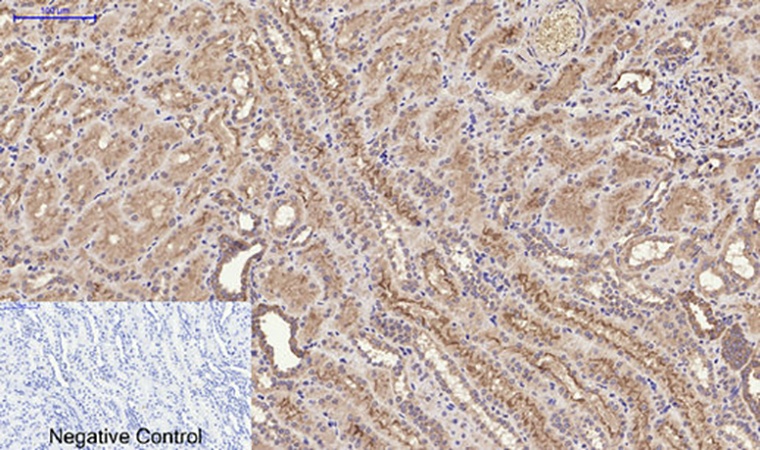Fig.3. Immunohistochemical analysis of paraffin-embedded human kidney tissue. 1, FAS Polyclonal Antibody was diluted at 1:200 (4°C, overnight). 2, Sodium citrate pH 6.0 was used for antibody retrieval (>98°C, 20min). 3, secondary antibody was diluted at 1:200 (room temperature, 30min). Negative control was used by secondary antibody only.