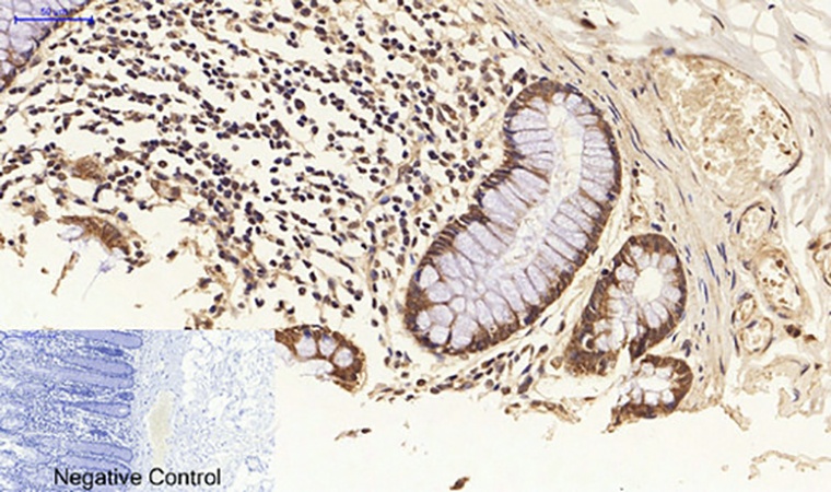 Fig.4. Immunohistochemical analysis of paraffin-embedded human colon tissue. 1, FAS-L Polyclonal Antibody was diluted at 1:200 (4°C, overnight). 2, Sodium citrate pH 6.0 was used for antibody retrieval (>98°C, 20min). 3, secondary antibody was diluted at 1:200 (room temperature, 30min). Negative control was used by secondary antibody only.