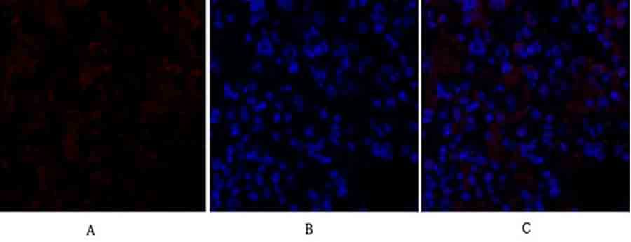 Fig.2. Immunofluorescence analysis of rat lung tissue. 1,  GSK3β Polyclonal Antibody (red) was diluted at 1:200 (4°C, overnight). 2,  Cy3 Labeled secondary antibody was diluted at 1:300 (room temperature, 50min). 3, Picture B: DAPI (blue) 10min. Picture A: Target. Picture B: DAPI. Picture C: merge of A+B.