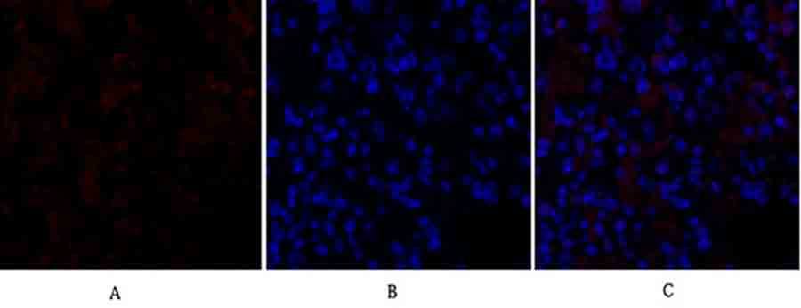 Fig.2. Immunofluorescence analysis of rat lung tissue. 1,  GSK3β Polyclonal Antibody (red) was diluted at 1:200 (4°C, overnight). 2,  Cy3 Labeled secondary antibody was diluted at 1:300 (room temperature, 50min). 3, Picture B: DAPI (blue) 10min. Picture A: Target. Picture B: DAPI. Picture C: merge of A+B.