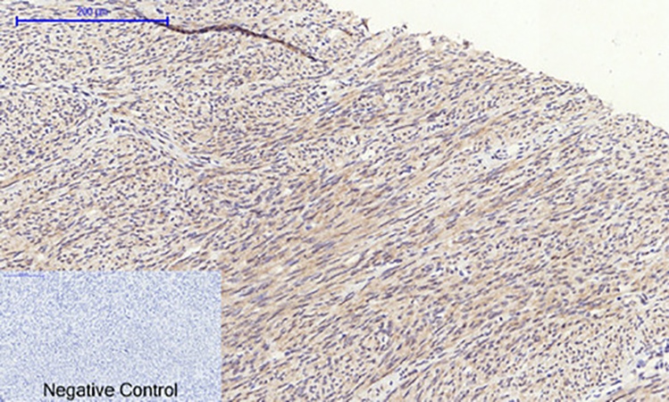 Fig.3. Immunohistochemical analysis of paraffin-embedded human uterus tissue. 1,  GSK3β Polyclonal Antibody was diluted at 1:200 (4°C, overnight). 2,  Sodium citrate pH 6.0 was used for antibody retrieval (>98°C, 20min). 3, secondary antibody was diluted at 1:200 (room temperature, 30min). Negative control was used by secondary antibody only.