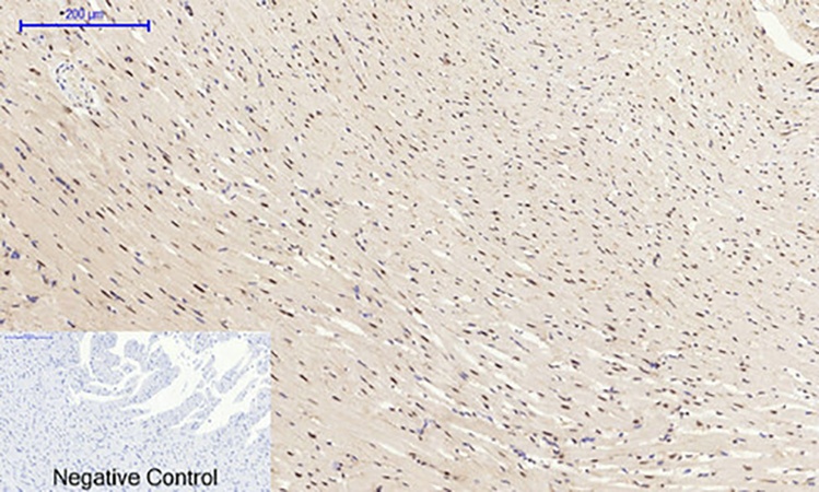 Fig.5. Immunohistochemical analysis of paraffin-embedded rat heart tissue. 1,  GSK3β Polyclonal Antibody was diluted at 1:200 (4°C, overnight). 2,  Sodium citrate pH 6.0 was used for antibody retrieval (>98°C, 20min). 3, secondary antibody was diluted at 1:200 (room temperature, 30min). Negative control was used by secondary antibody only.
