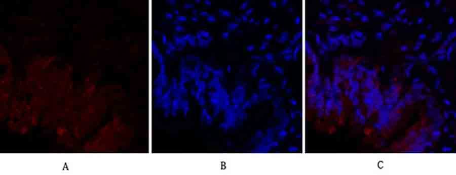 Fig.3. Immunofluorescence analysis of rat lung tissue. 1, HIF-1α Polyclonal Antibody (red) was diluted at 1:200 (4°C, overnight). 2, Cy3 Labeled secondary antibody was diluted at 1:300 (room temperature, 50min). 3, Picture B: DAPI (blue) 10min. Picture A: Target. Picture B: DAPI. Picture C: merge of A+B.