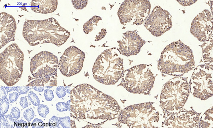Fig.5. Immunohistochemical analysis of paraffin-embedded mouse testis tissue. 1, HIF-1α Polyclonal Antibody was diluted at 1:200 (4°C, overnight). 2, Sodium citrate pH 6.0 was used for antibody retrieval (>98°C, 20min). 3, secondary antibody was diluted at 1:200 (room temperature, 30min). Negative control was used by secondary antibody only.
