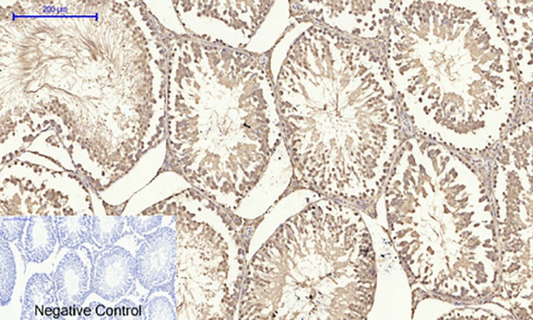 Fig.6. Immunohistochemical analysis of paraffin-embedded rat testis tissue. 1, HIF-1α Polyclonal Antibody was diluted at 1:200 (4°C, overnight). 2, Sodium citrate pH 6.0 was used for antibody retrieval (>98°C, 20min). 3, secondary antibody was diluted at 1:200 (room temperature, 30min). Negative control was used by secondary antibody only.