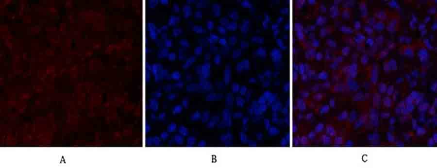 Fig.2. Immunofluorescence analysis of rat lung tissue. 1, Histone H2A.X Polyclonal Antibody (red) was diluted at 1:200 (4°C, overnight). 2, Cy3 Labeled secondary antibody was diluted at 1:300 (room temperature, 50min). 3, Picture B: DAPI (blue) 10min. Picture A: Target. Picture B: DAPI. Picture C: merge of A+B.