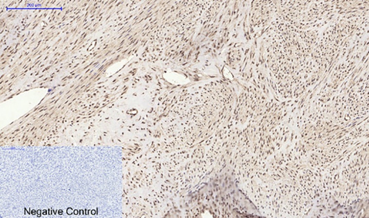 Fig.3. Immunohistochemical analysis of paraffin-embedded human uterus tissue. 1, Histone H2A.X Polyclonal Antibody was diluted at 1:200 (4°C, overnight). 2, Sodium citrate pH 6.0 was used for antibody retrieval (>98°C, 20min). 3, secondary antibody was diluted at 1:200 (room temperature, 30min). Negative control was used by secondary antibody only.