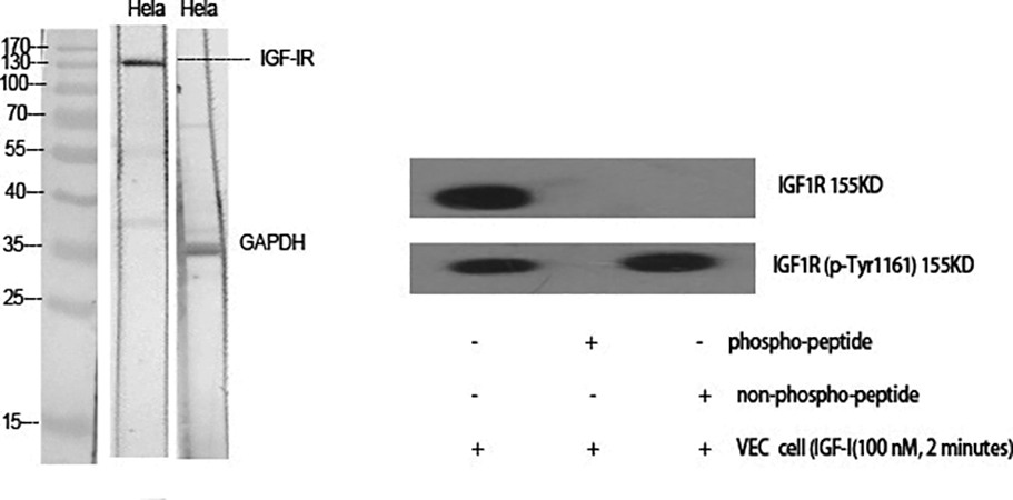 Fig.1. Western Blot analysis of various cells using IGF-IR Polyclonal Antibody diluted at 1:2000.