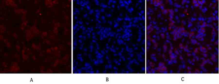 Fig.2. Immunofluorescence analysis of mouse lung tissue. 1, IGF-IR Polyclonal Antibody (red) was diluted at 1:200 (4°C, overnight). 2, Cy3 Labeled secondary antibody was diluted at 1:300 (room temperature, 50min). 3, Picture B: DAPI (blue) 10min. Picture A: Target. Picture B: DAPI. Picture C: merge of A+B.