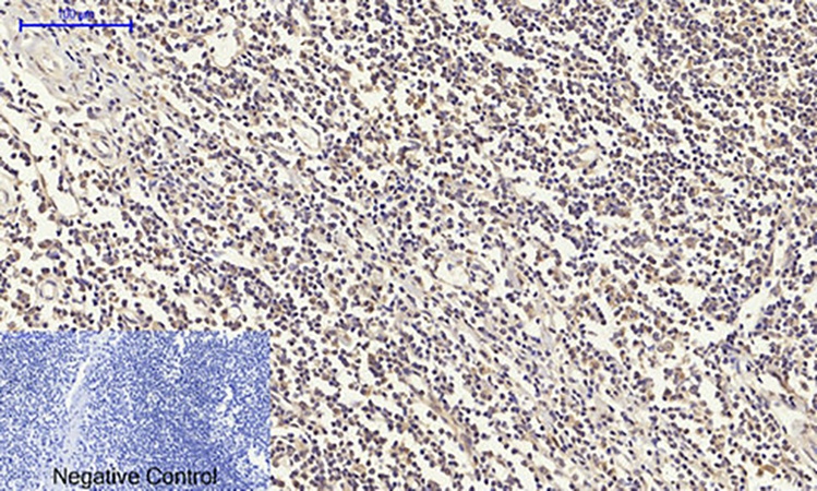 Fig.4. Immunohistochemical analysis of paraffin-embedded human tonsil tissue. 1, IGF-IR Polyclonal Antibody was diluted at 1:200 (4°C, overnight). 2, Sodium citrate pH 6.0 was used for antibody retrieval (>98°C, 20min). 3, secondary antibody was diluted at 1:200 (room temperature, 30min). Negative control was used by secondary antibody only.